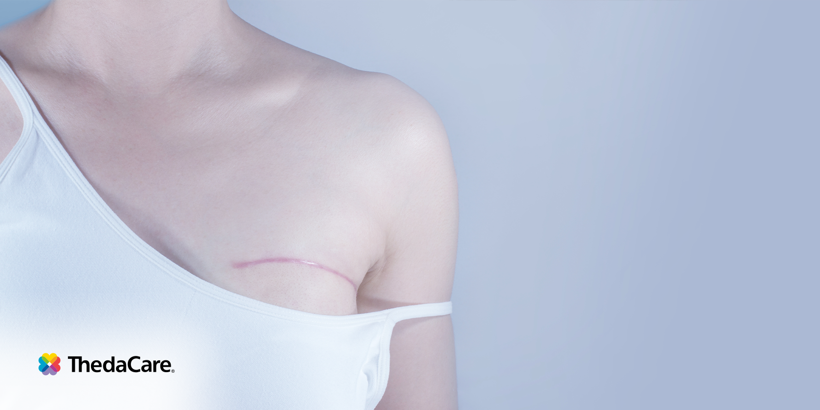 How to Support a Loved One During Their Mastectomy Journey